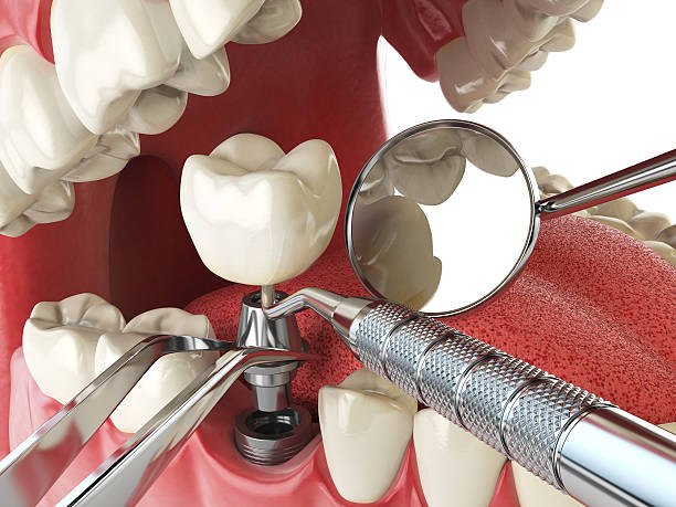 Best Emergency Tooth Extraction  in North Tunica, MS
